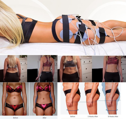 Geschiktheid van de de Stimulatiemachine van de salon de Elektrische EMS Spier voor Cellulite